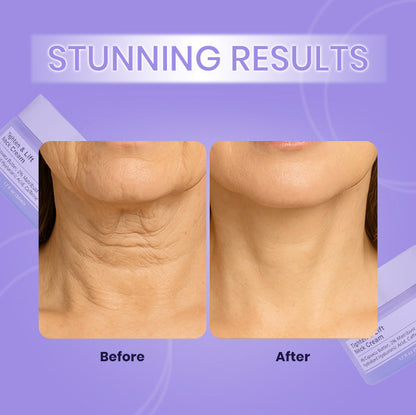 Neck Cream