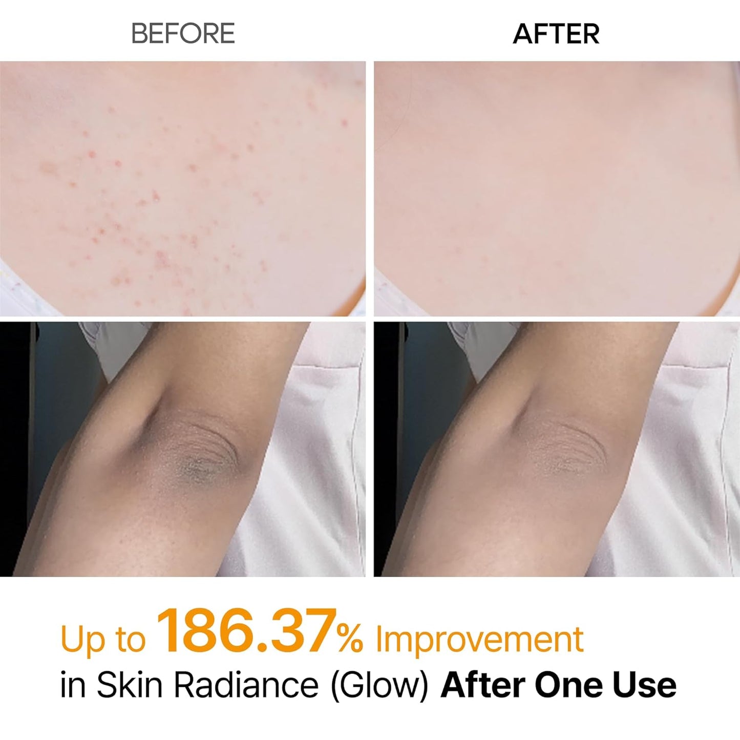 Dr. Melaxin - Peel Shot Kojic Acid Spray
